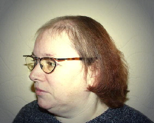 vorher
